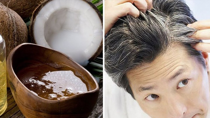 Sử dụng dầu dừa: Dầu dừa có thể được sử dụng vì rất nhiều lý do. Đó là một loại dầu ăn ngon, hoạt động như một loại kem dưỡng ẩm da và cũng rất tốt cho tóc của bạn. Nếu bạn massage tóc bằng dầu dừa thường xuyên, nó sẽ giữ ẩm và từ đó sẽ làm mềm và tăng cường các sợi tóc, đồng thời cung cấp chất chống oxy hóa có thể giúp làm chậm tóc bạc trong một thời gian dài.