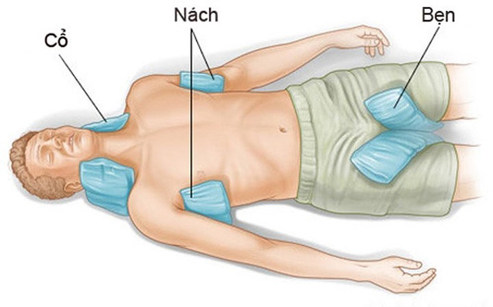Khi gặp trường hợp say nắng, say nóng cần nhanh chóng tiến hành những biện pháp sơ cứu ngay lập tức khi chưa có sự hỗ trợ của nhân viên y tế hay phương tiện y tế: Nhanh chóng tiến hành giảm thân nhiệt cho nạn nhân. Chuyển ngay nạn nhân vào chỗ mát, thoáng gió, cởi bỏ bớt quần áo, cho uống nước mát có pha muối, chườm lạnh bằng khăn mát hoặc nước đá ở những vị trí có động mạch lớn đi gần ngoài da như nách, bẹn, cổ.