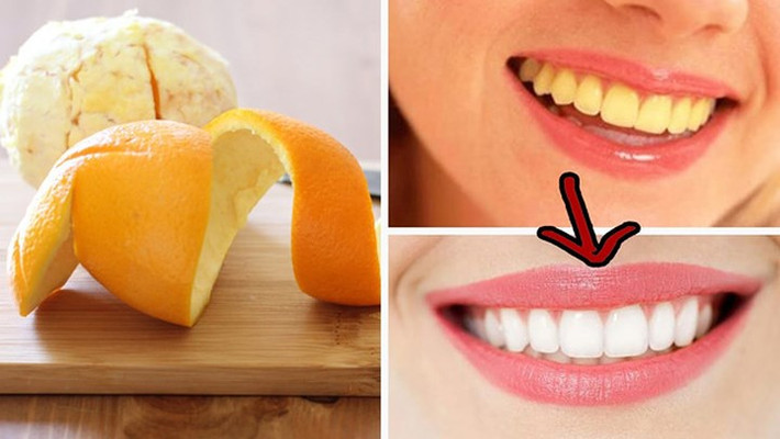 Bảo vệ răng: Nhờ tính chất kháng khuẩn của vỏ cam, chúng bảo vệ bạn khỏi sâu răng. Ngoài ra, bạn cũng có thể làm trắng răng bằng cách sử dụng vỏ cam. Các limonene trong vỏ cam cũng làm trắng răng của bạn một cách tự nhiên.