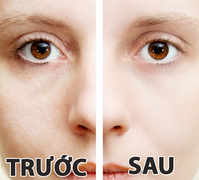 1. Dùng nước gạo để làm se khít lỗ chân lông Theo nghiên cứu, nước gạo là một trong những mẹo làm đẹp hiệu quả, có thể làm lỗ chân lông se khít. Cách làm: Bạn có thể dùng nước gạo nấu cơm hoặc làm nước gạo bằng cách ngâm gạo với nước theo tỉ lệ 1 bát gạo: 2 bát nước. Sau khi ngâm gạo 15 phút thì lọc gạo ra. Lấy bông thấm vào bát nước gạo và xoa đều lên mặt. Sau khi da khô bạn sẽ thấy da sáng lên trông thấy.