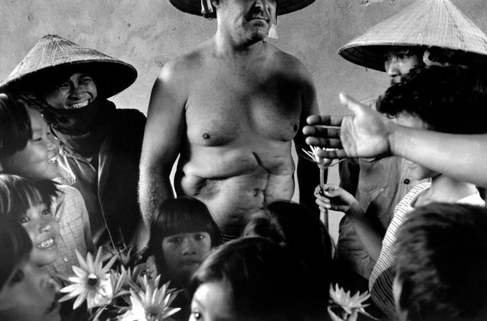 Cựu chiến binh của Mỹ John Bacca trong một hoạt động thiên nguyện ở thị trấn Yên Viên, Gia Lâm, Hà Nội năm 1990. Cựu chiến binh này đã bị thương nặng do trúng lựu đạn trong thời chiến tranh Việt Nam và mắc chứng rối loạn căng thẳng sau chấn thương thời hậu chiến. Ảnh: Larry Towell - Magnumphotos.com