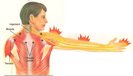 Trong hầu hết các trường hợp, bác sĩ chỉ có thể xác định được nguyên nhân gây đau trực tiếp sau khi đã loại bỏ hết các nguyên nhân lâm sàng. Khoa học vẫn đang tìm cách xác định các kiểu đau quy chiếu để tìm ra những cách điều trị hợp lý nhất. Sau đây là những dạng đau quy chiếu phổ biến nhất.