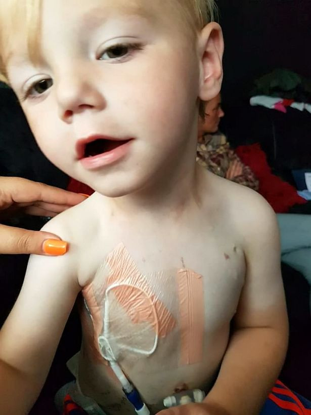 Cô Zoey nói “mỗi lần bé nhập viện là tôi không biết liệu có thể trở về nhà cùng với con mình hay không. Bé không có hệ miễn dịch nên rất dễ bị nhiễm khuẩn. Các bác sĩ cho rằng căn bệnh của Liam là duy nhất trên thế giới vì mặc dù đã kiểm tra nhiều lần nhưng vẫn không xác định được nguyên nhân của căn bệnh lạ này”. (Nguồn ảnh: Mirror)