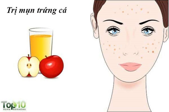 Chữa trị mụn trứng cá: Mụn trứng cá là một vấn đề thường gặp ở phụ nữ. Các axit alpha hydroxy trong giấm táo giúp loại bỏ các tế bào da chết làm tắc nghẽn các lỗ chân lông. Giữ các lỗ chân lông trên da sạch vi khuẩn, dầu và các hạt bụi bẩn là bí quyết để làn da không có mụn. Ngoài ra, nó giúp khôi phục và cân bằng độ pH của da, điều cần thiết để ngăn ngừa mụn trứng cá.
