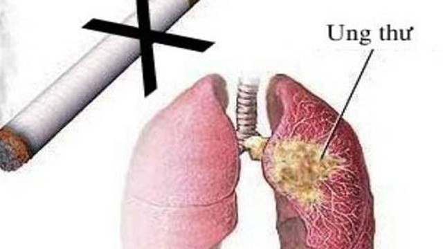 9. Khói Từ "khói" ở đây đầu tiên chính là chỉ thuốc lá, một trong những nhân tố gây tử vong do ung thư phổi hàng đầu trên thế giới. Thứ hai là khói bốc ra từ quá trình nấu nướng cũng có khả năng gây bệnh nếu không có biện pháp xử lý thích đáng.