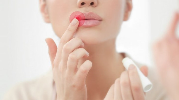 Nhiều tác dụng phụ: May mắn là thay hầu hết các tác dụng phụ có thể có của tiêm môi đều nhẹ và tạm thời. Các rủi ro phổ biến khác có thể là bầm tím, sưng... và thường chỉ kéo dài trong một vài ngày.