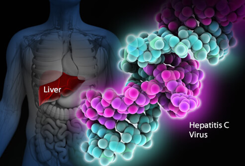 Triệu chứng thông thường là mệt mỏi, đau khớp, đầu óc mụ mị (lúc này virus đã tấn công vào não khiến các tế bào thần kinh không thể gửi nhận thông tin). Tuy nhiên, những triệu chứng này cũng có thể không rõ ràng khiến người bệnh chỉ cảm thấy không khỏe khi các tế bào gan đã bị hư hại và vàng da.
