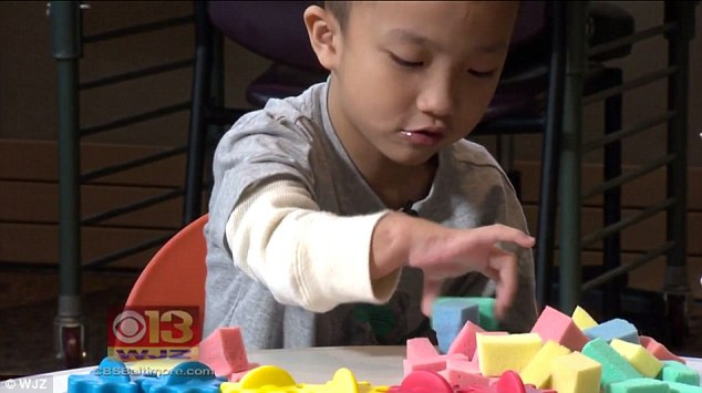Các bác sĩ đã lấy một mảnh xương, khớp và sụn tiến hợp từ chân của Lal để khiến cánh tay và bàn tay có thể hoạt động được. Hai bước đầu tiên của quá trình phẫu thuật được tiến hành như bình thường, đầu tiên là cố định bàn tay trên cổ tay, sau đó cố định cho thẳng hơn.