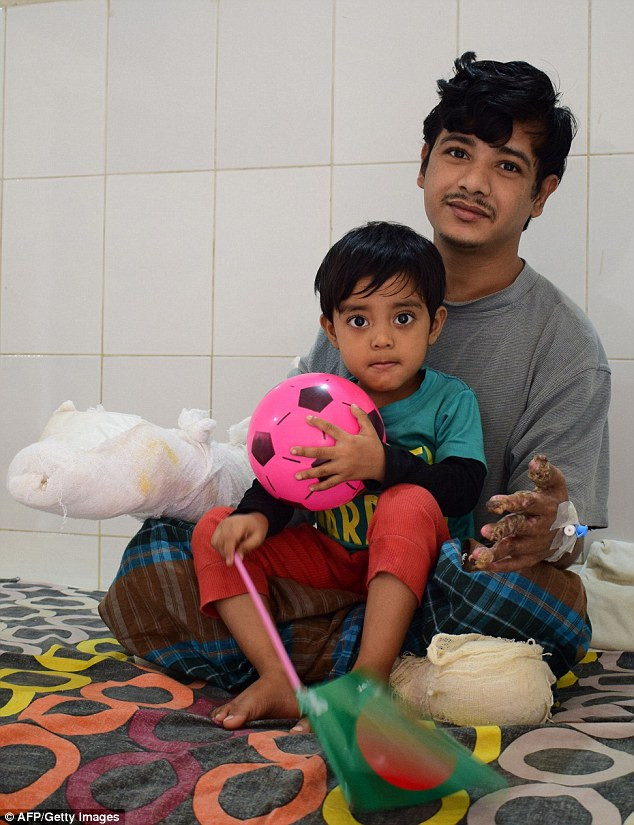 Bác sĩ Samanta Lal Sen – điều phối viên phẫu thuật thẩm mỹ tại Bệnh viện đại học y Dhaka cho biết: “Việc cứu chữa cho anh Abul là một cột mốc trong lịch sử ngành y…Hiện tay và chân của anh Abul đã ổn và sẽ được ra viện trong vòng 30 ngày nữa sau vài tiểu phẫu để bảo vệ hình dáng bàn tay”. Nếu các khối bướu cây không mọc trở lại, anh Abul sẽ là người đầu tiên trên thế giới được chữa khỏi bệnh này.