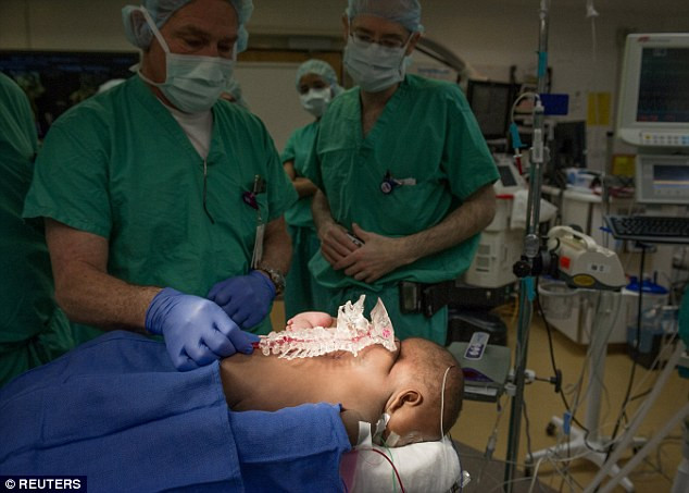 Nếu không phẫu thuật, tim và phổi của bé buộc phải hoạt động gấp đôi khiến cuộc sống của bé bị rút ngắn lại.