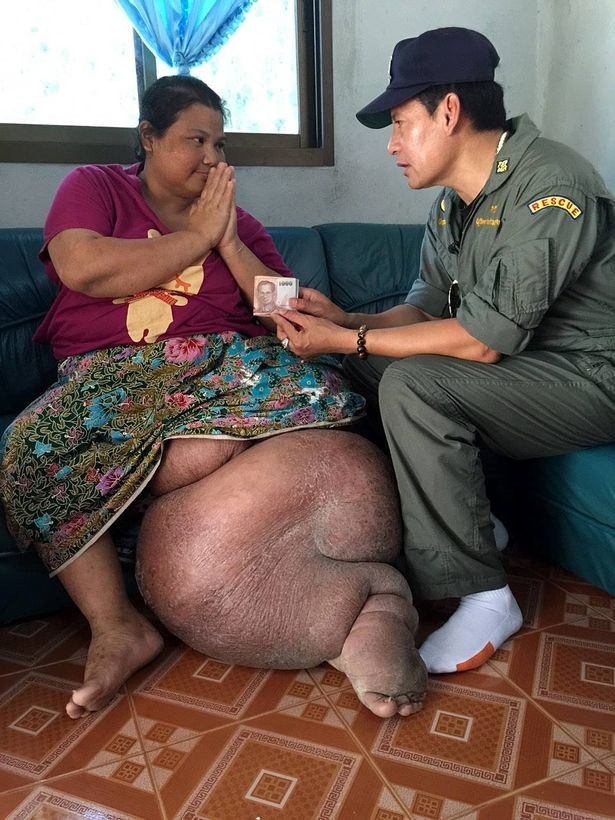 Sau khi đổ bệnh, cô phải bỏ toàn bộ số tiền dành dụm ít ỏi cho việc chữa trị nhưng vẫn không khỏi. Thêm nữa, người chồng đã phụ bạc khiến cô càng bế tắc. Để đỡ đần gia đình, các con cô Juan buộc phải bỏ học để trở thành lao động trẻ em tại công trường cao su và chăm sóc mẹ.