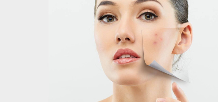 Ngoài ra, khi chăm sóc da tuổi 30 cần lưu ý da khô và nhạy cảm hơn. Nếu dùng kem trị mụn mạnh thì da sẽ bị khô và kích ứng. Nên chuyển sang các sản phẩm trị mụn dịu nhẹ hơn nhưng vẫn hiệu quả, chẳng hạn như có chứa sulfur. Ngoài ra còn cần thay đổi kem dưỡng ẩm sang loại dưỡng ẩm nhiều hơn, ví dụ dưỡng ẩm có chứa vitamin C.