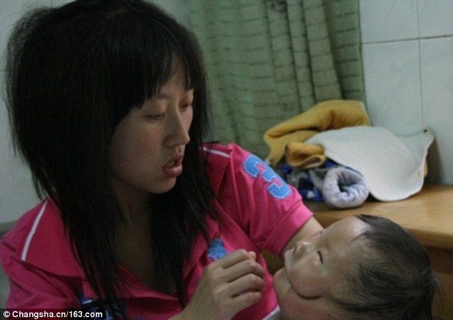Bé Huikang sinh ngày 4/3/2009 trong một gia đình nông dân kinh tế khiêm tốn. Không giống như những bà mẹ khác khi được gặp con mình lần đầu tiên thì vô cùng vui sướng, cô Yi Lianxi – mẹ bé Huikang – đã vô cùng đau khổ.