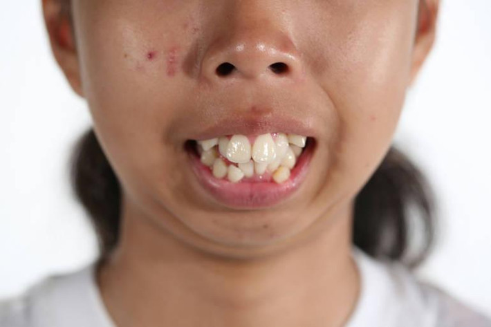Nhưng cuộc sống của thiễu nữ này đã thay đổi hoàn toàn sau khi cô chiến thắng trong một chương trình tài năng và được đưa tới Hàn Quốc để phẫu thuật thẩm mỹ.