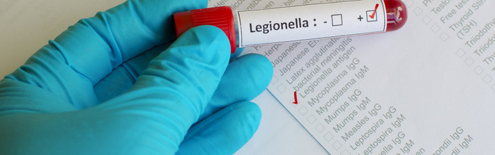 Ngoài ra, khuẩn Legionella còn có thể gây ảnh hưởng đến cả thần kinh, nếu không phát hiện và điều trị kịp thời thì khả năng tử vong là hoàn toàn có thể. (Ảnh: safetyconcepts)
