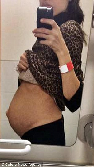 Maria Christofi, 42 tuổi, hiện sống tại Bắc London được chẩn đoán là bị u xơ tử cung – một dạng u lành nằm trong tử cung – từ cách đây 10 năm. Lúc này khối u mới chỉ dài 5cm nhưng Maria quyết định không mổ.