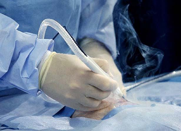 Hít phải khói phẫu thuật: Khói phẫu thuật tỏa ra khi sử dụng những dụng cụ bằng điện siêu nóng để đốt da và các tế bào. 95% những dụng cụ này được dùng trong quá trình phẫu thuật. Khói phẫu thuật chứa hơn 150 chất hóa học - rất nhiều chất trong số này không khác gì hóa chất trong thuốc lá – trong đó có 16 chất được coi là chất gây ô nhiễm cao, ngoài ra còn có chất độc, chất sinh ung thư, virus, vi khuẩn.