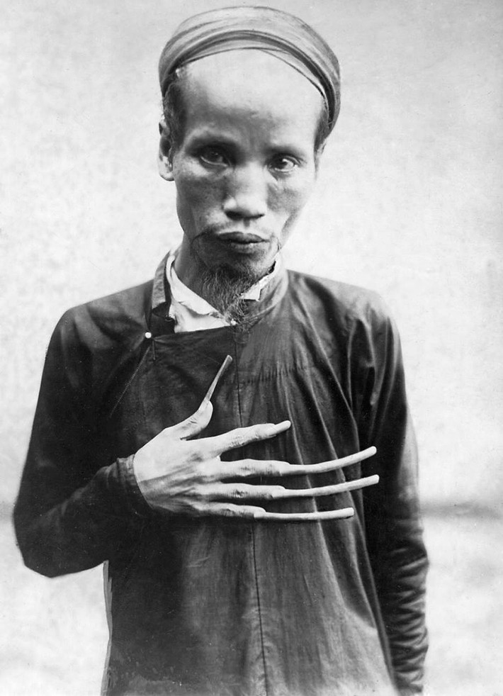 Một nho sĩ An Nam kiêu hãnh khoe móng tay dài, thập niên 1920. Trong xã hội Nho giáo, chỉ những người thuộc tầng lớp thượng lưu, không phải lao động chân tay mới để móng dài. Ảnh tư liệu.