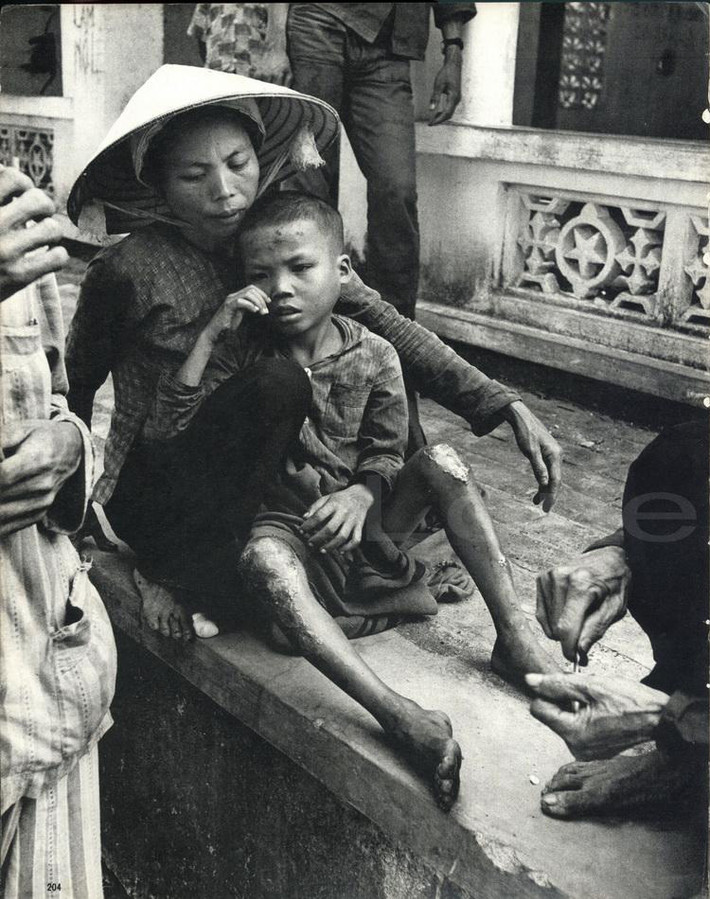 Một em bé vừa bị đưa vào trại tập trung cùng mẹ.