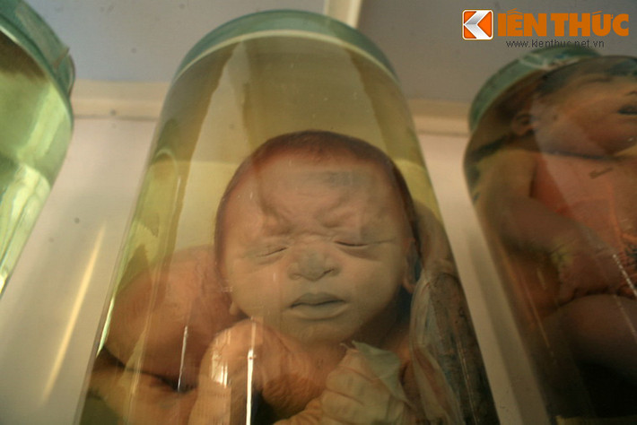 Khuôn mặt các em như cũng biểu lộ sự đau đớn tột cùng khi không thể trở thành một con người trọn vẹn..