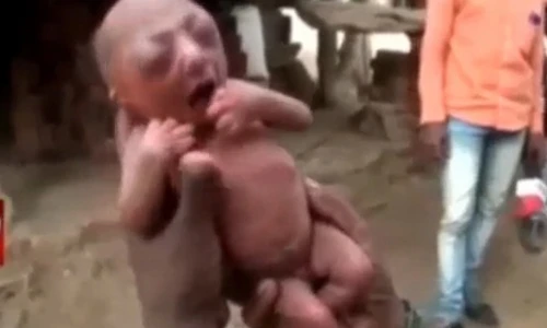 Bé sơ sinh bị bỏ rơi vì hình dạng giống cụ già