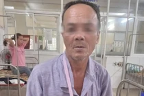 Người đàn ông nhập viện vì bị khỉ xông vào nhà và tấn công