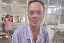 Người đàn ông nhập viện vì bị khỉ xông vào nhà và tấn công