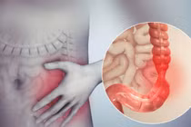 Căn bệnh đường ruột phổ biến, nhiều người không để ý