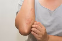 Giải mã lý do nhiễm khuẩn đường huyết có tỷ lệ tử vong cao