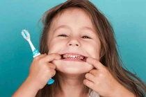 Nguyên nhân khiến trẻ bị sâu răng dù đánh răng đều đặn