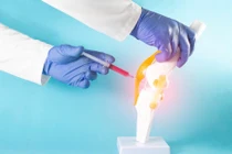 Liệu pháp tế bào gốc, cách mạng y học cho bệnh thoái hóa