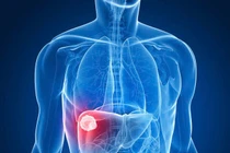 Bảo vệ gan mỗi ngày từ những thay đổi nhỏ trong bữa ăn