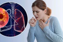 Ung thư phổi không do hút thuốc, cảnh báo mối nguy mới