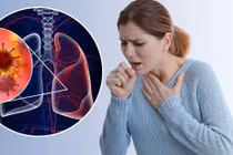 Ung thư phổi không do hút thuốc, cảnh báo mối nguy mới