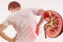 Ăn nhiều thực phẩm giàu đạm, muối ảnh hưởng đến thận ra sao?