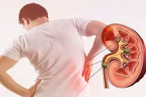 Ăn nhiều thực phẩm giàu đạm, muối ảnh hưởng đến thận ra sao?