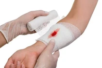 Học cách sơ cứu cơ bản, kỹ năng ai cũng cần