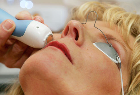 Điều trị da Thermage: Ứng dụng cho da chảy xệ, nhăn nheo. Thiết bị này sử dụng năng lượng tần số radio để làm nóng da. Nhiệt năng sẽ kích thích cơ thể sản xuất collagen, làm săn chắc da. Thermage có thể gây đau, nhưng một lần điều trị là đủ cho kết quả tốt.
