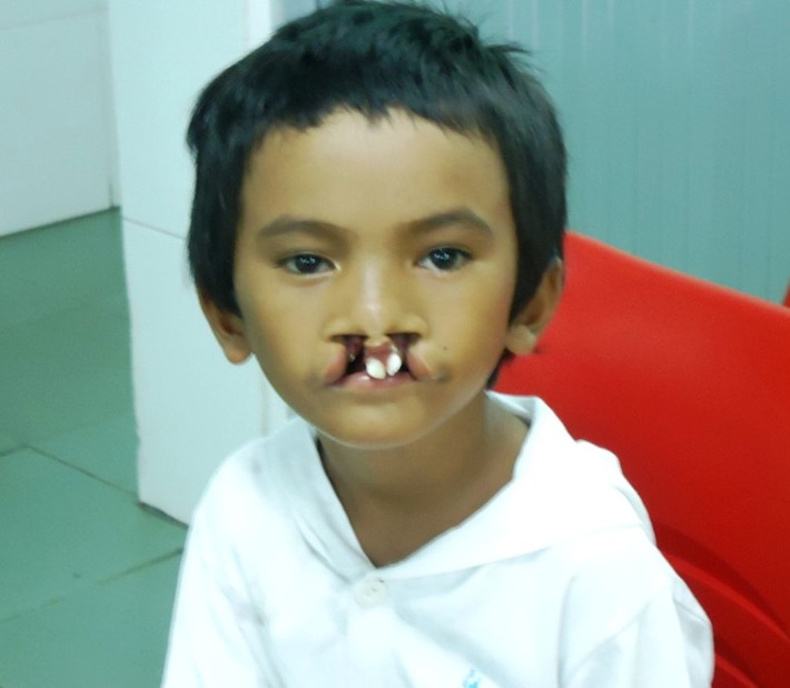 Tổ chức Smile Train - tổ chức phi chính phủ của Hoa Kỳ đã liên lạc với anh Trần Trọng Lượm - tác giả bức ảnh để cất công tìm lại cậu bé. Sáng 27/11, cậu bé Tà Yên Nghiệp được ekip gồm 4 bác sĩ Bệnh viện Nhi đồng 1 TP HCM tiến hành phẫu thuật vá môi, tạo hình mũi. Ca mổ kéo dài khoảng 2 tiếng đồng hồ.