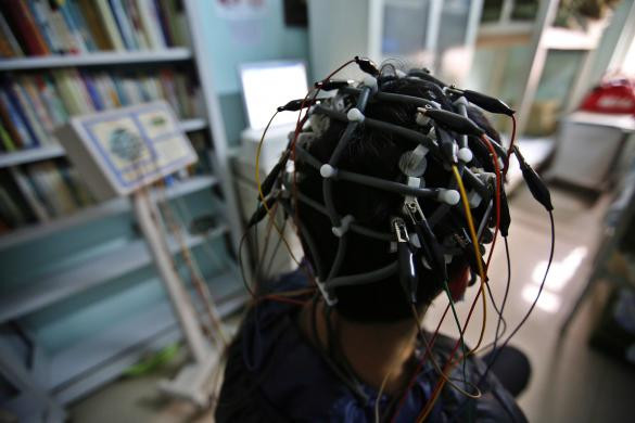 Một cậu bé nghiện internet, được quét não để các bác sĩ đưa ra phác độ điều trị phù hợp.