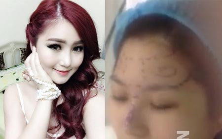 10. Hương Tràm lộ clip dao kéo; Chánh Tín mất nhà ra đường Cư dân mạng không khỏi xôn xao khi một đoạn clip dài 3 phút, ghi lại cảnh quán quân The Voice - Hương Tràm đang được sửa mặt trong phòng phẫu thuật của một thẩm mỹ viện được tung lên mạng, thậm chí còn để lộ luôn cả vòng 1 trong đoạn clip.