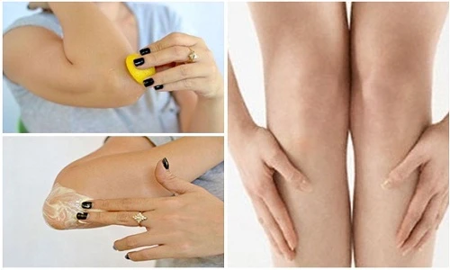 Mẹo làm trắng da vùng khuỷu tay và đầu gối