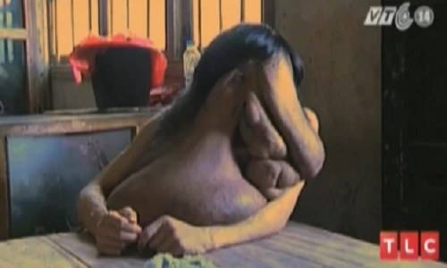 Kỳ lạ người đàn ông mặt voi