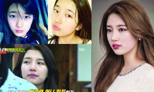 Suzy bị “tố” phẫu thuật thẩm mỹ nhiều lần
