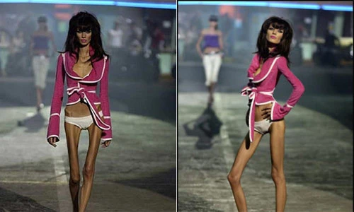 Rùng mình xem những người mẫu gầy trơ xương trên sàn diễn