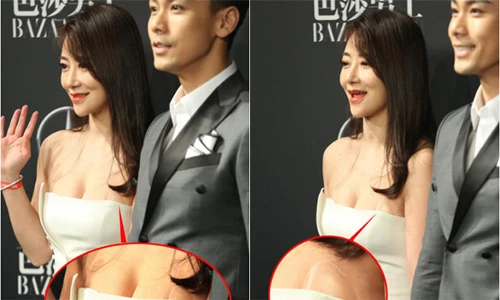 Sao Hoa ngữ kém xinh vì lộ miếng dán ngực