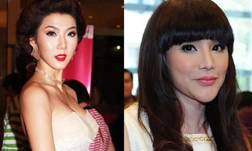 Sao Việt khác lạ vì làm đẹp bằng dao kéo