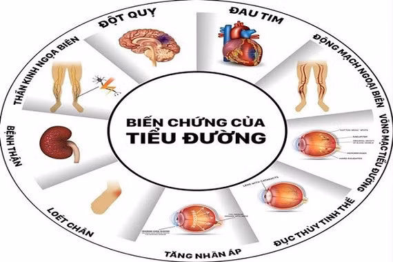 70% người Việt không biết mình mắc bệnh tiểu đường 