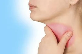 4 kiểu ăn uống dẫn đến ung thư thực quản