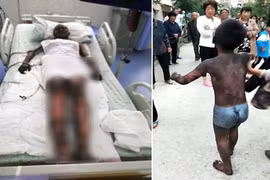 Chuyện lạ hôm nay: “Đừng lo... có mẹ” và điều cảm động trong đám cháy 